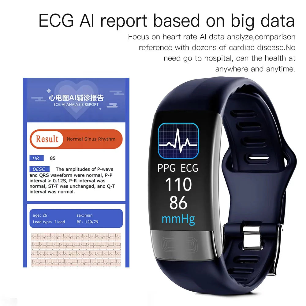Smartwatch EKG & Blood Pressure Monitor  – Bricodil BCD6249